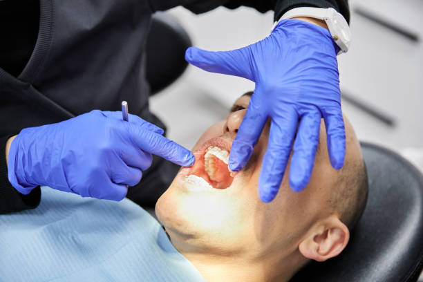 Best Emergency Tooth Extraction in Ralston, NE